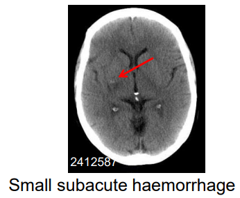 00ce153158691efa32ea8b7931345c50.png