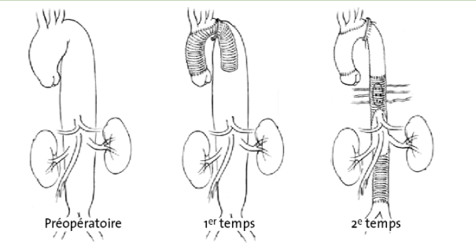 8342e96ec43536694b990ee5d0ae2cd7.png
